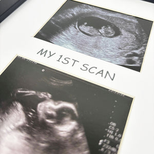 My First Scan Photo Frame | Black