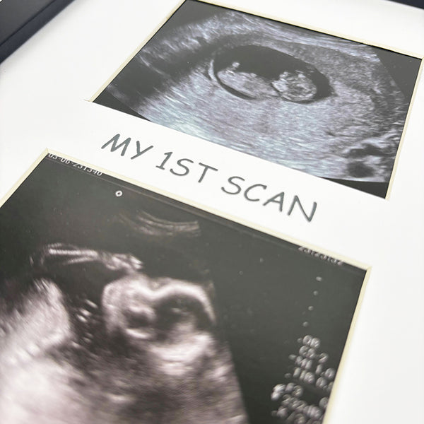 My First Scan Photo Frame | Black